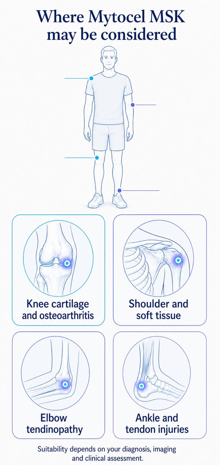 Illustrated map of the joints and cartilage problems where Mytocel MSK may be considered, ending with a note that suitability is a clinical judgement